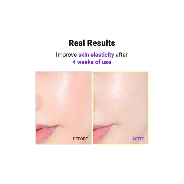 Isntree - Hyper Retinol EX 1.0 Serum 20ml | We are Authorized Wholesaler - Image 5